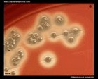 GAS (Group A Streptococci)